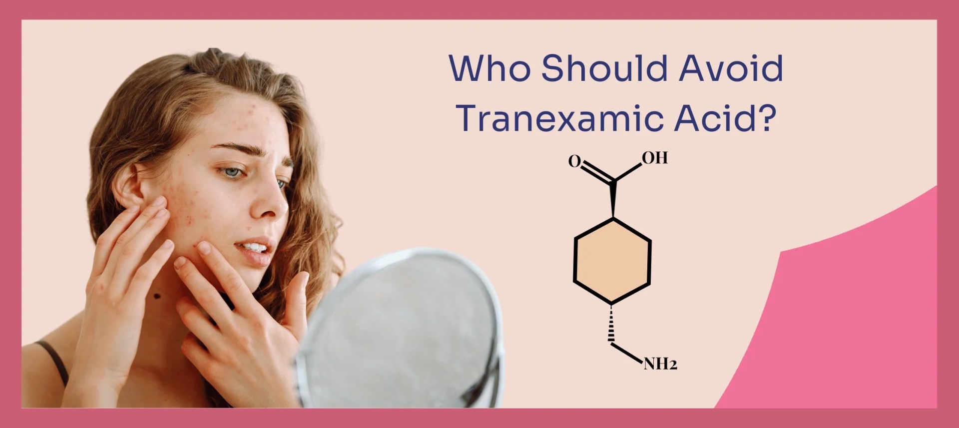 网红“氨甲环酸”被批准用于色斑治疗了吗？